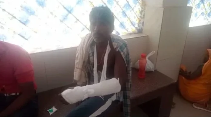 सीधी:- रास्ते के विवाद में युवक पर लाठी-डंडों से हमला, हाथ टूटा, हालत गंभीर