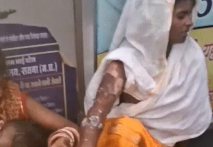 मैहर में दर्शन को जा रहे श्रद्धालुओं की पिकअप पलटी, 11 घायल – 6 लोग गर्म सब्जी गिरने से झुलसे